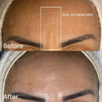 Mediplorer CO2 Gel Mask (6 packs)