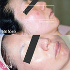 Mediplorer CO2 Gel Mask (6 packs)