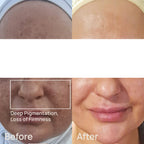 Mediplorer CO2 Gel Mask Premium (6 pack)