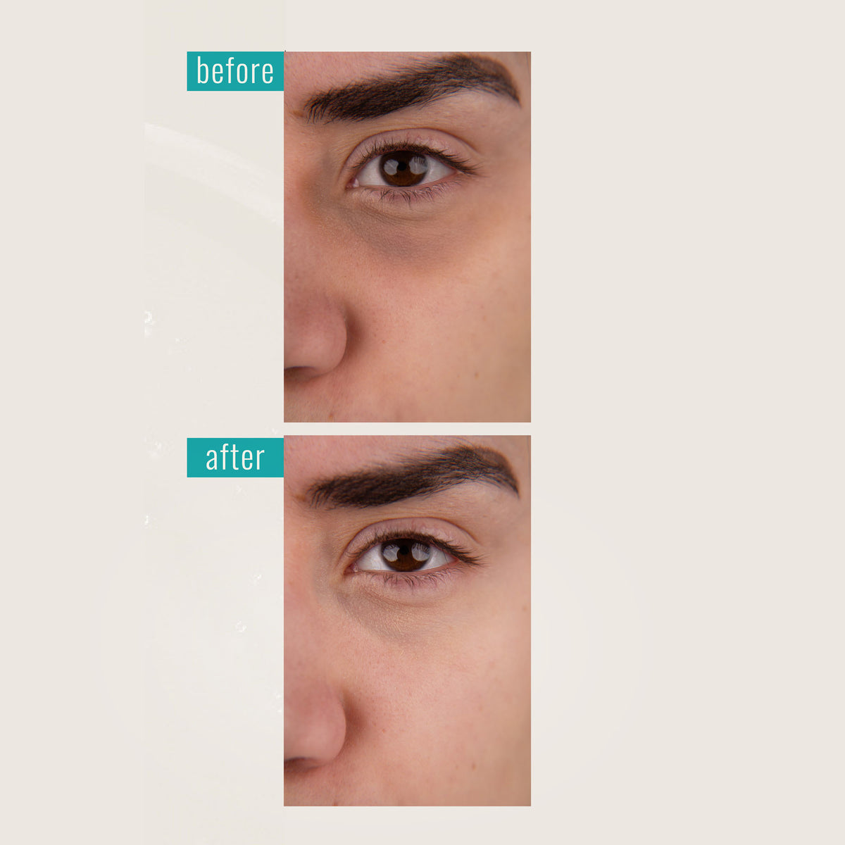 Dr. MEDION Carbonated Mask Spaoxy Gel