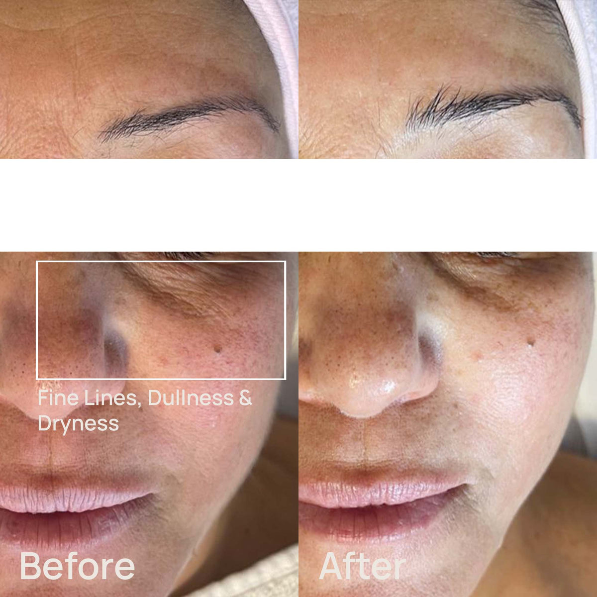 Dr. MEDION Carbonated Mask Spaoxy Gel